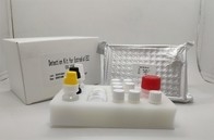 Antígeno do núcleo de Igg Elisa Kit For Hepatitis B do teste de diagnóstico do plasma do soro