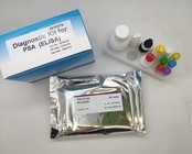 Antígeno Elisa Home Test Kit do núcleo do vírus da hepatite B 96 partes da eficiência elevada