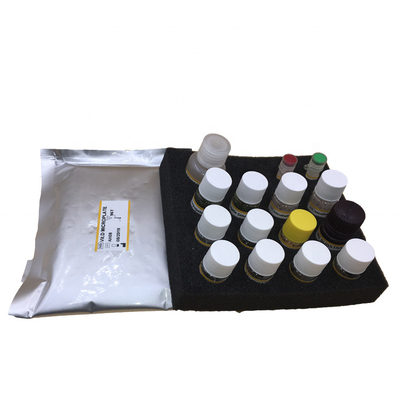 Uso bom de Elisa Test Kit Plate Human do reagente de HBeAb do plasma 96 do soro