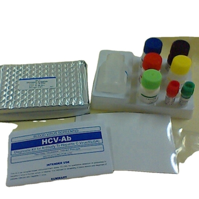 Interleukin 1 beta jogo Il1b humano Elisa Kit Reaserch Use da detecção do elisa